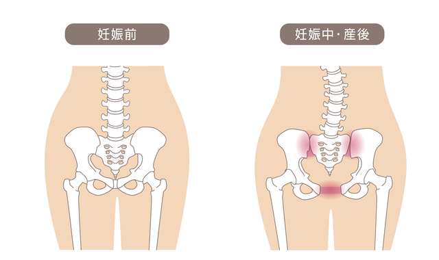 妊娠中の骨盤