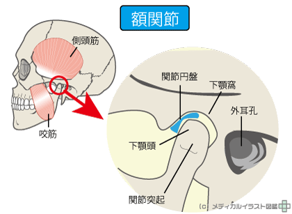 顎関節から音が鳴るのはなぜ？