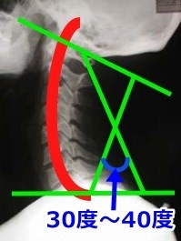 正常な頚椎の角度