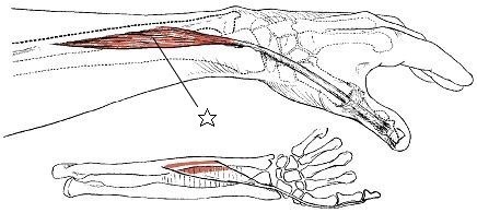 頭板状筋のトリガーポイント